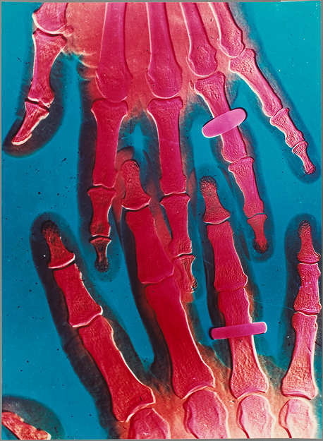 Isaac Kitrosser, Chromogenic X-ray From the collection of the Musée français de la photographie