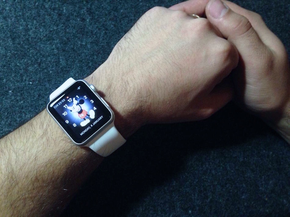 Apple-Watch- 1