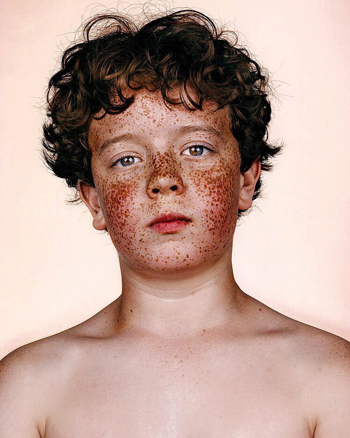 freckles-portrait-photography-brock-elbank-108__700